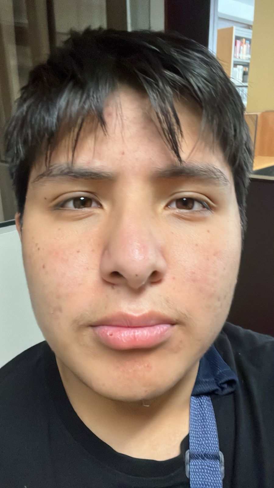 Foto pendiente